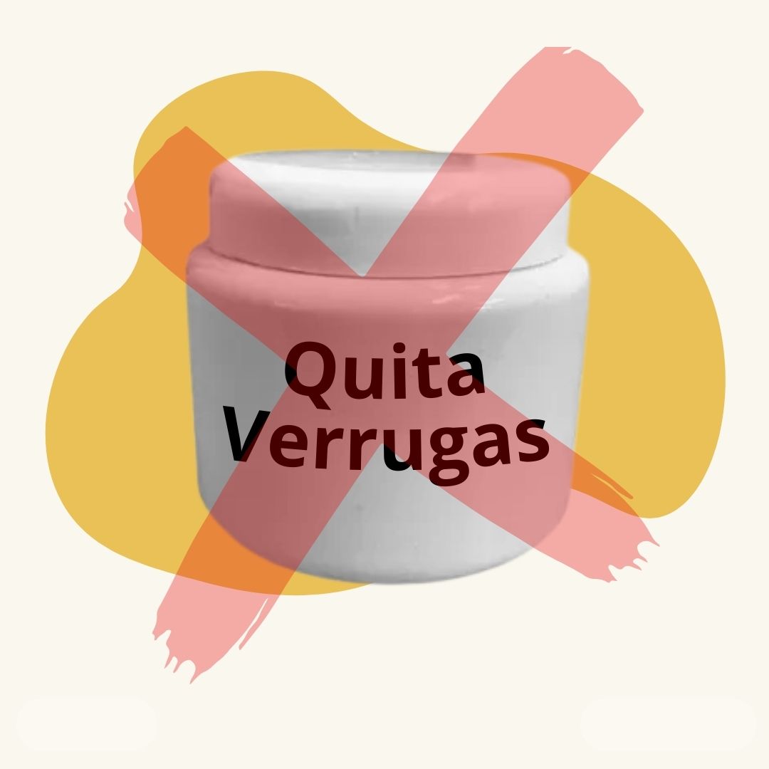 Otras Opciones