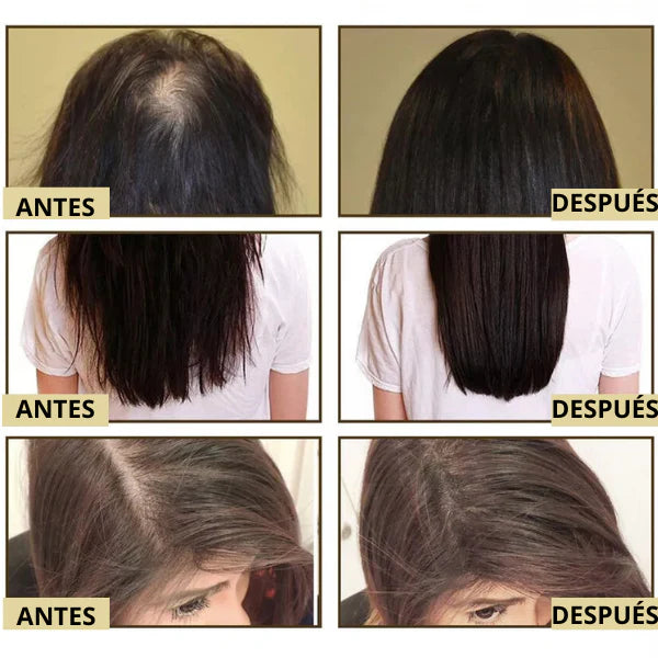 Aceite Natural Veganic™ | Crecimiento Del Cabello