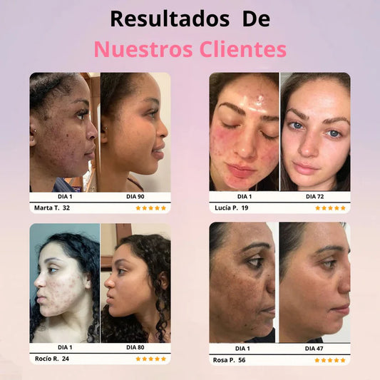 Varita De Fototerapia | Medicina Estética